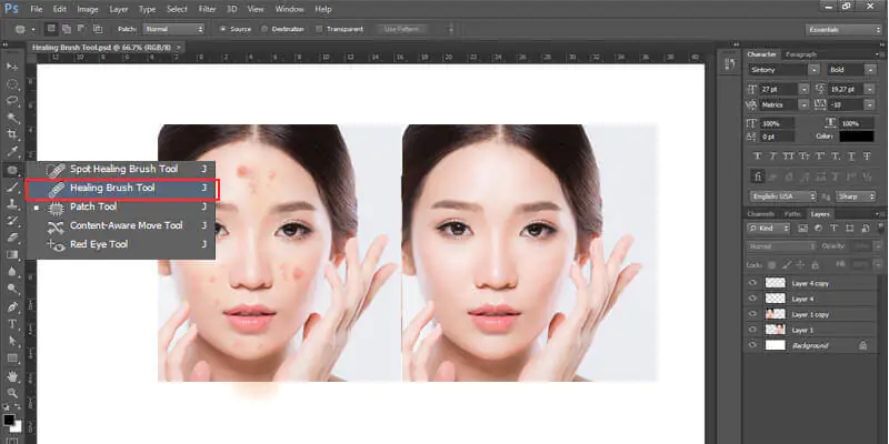 Removing Blemishes Or Wrinkles From A Portrait In Photoshop
